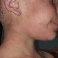 UPDATE 27.03.2023 – Ajuta-l pe Gabriel sa ajunga la spital