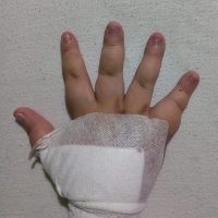 UPDATE 28.10.2025 – Raul are nevoie de sprijinul nostru pentru a continua tratamentul vital în Austria